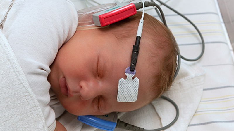 Newborn with ALGO supplies including Hydrogel Adhesive Sensors and Proprietary Acoustic Earphones during hearing screening.