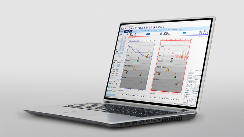 Aurical IQ Aud fitting audiometer software on a laptop.