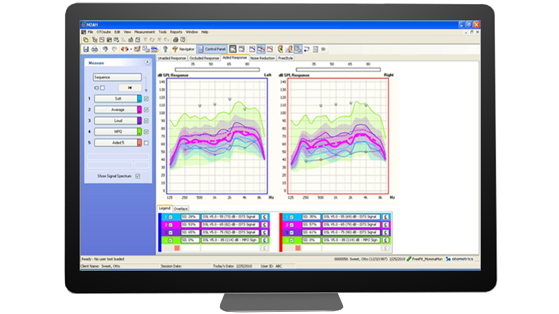 Hearing aid fitting software interface showing real ear measurement results with Aurical FreeFit.