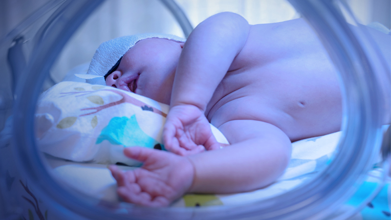 Biliband eye protection for neonatal phototherapy