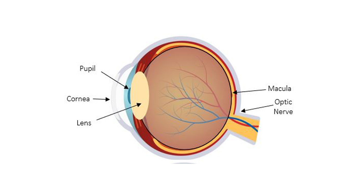 Congenital Eye Disease