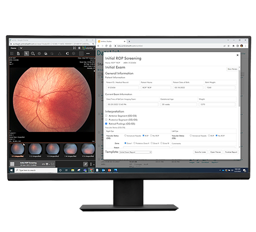 Retinal image and electronic medical record interface using Datalink for RetCam Envision, facilitating integrated eye screening documentation.