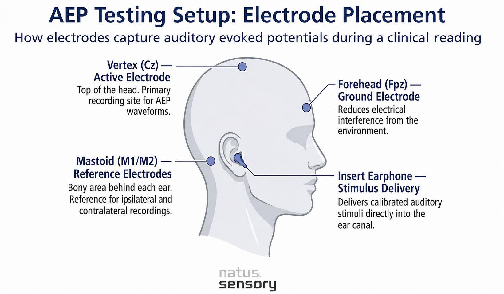 Electrode placement for AEP