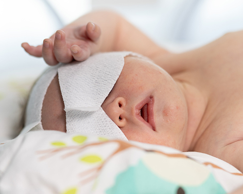 Eye protection in neonatal phototherapy