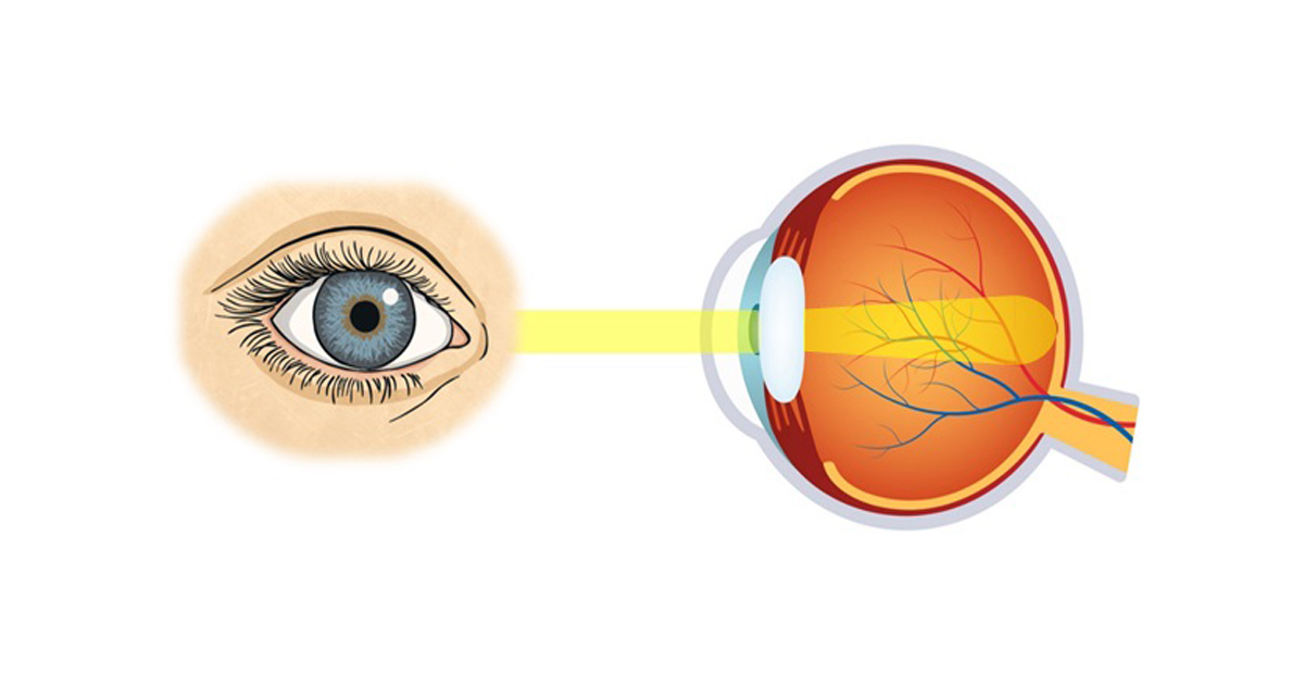 Overcoming Imaging Obstacles