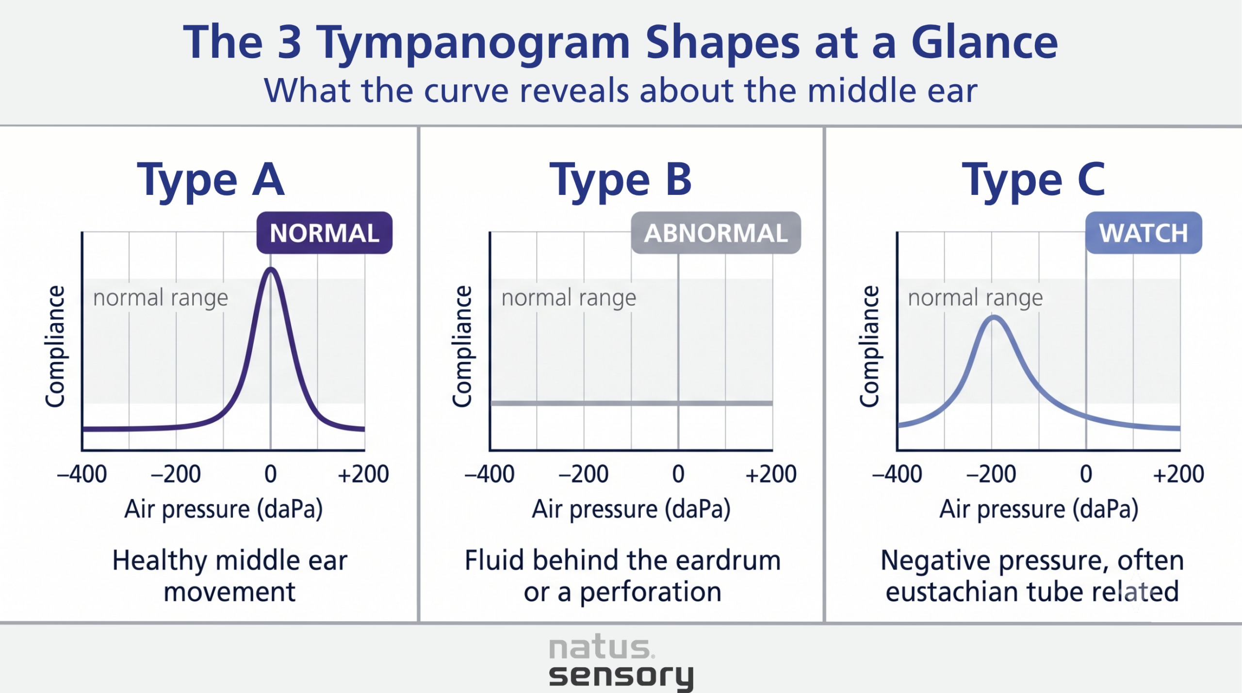Tympanogram shapes at a glance