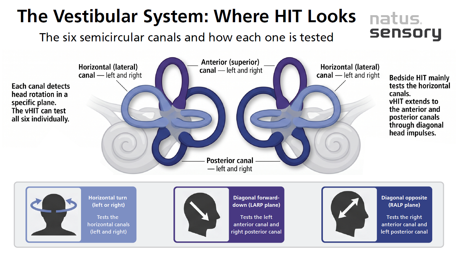The Vestibular System: Where HIT Looks