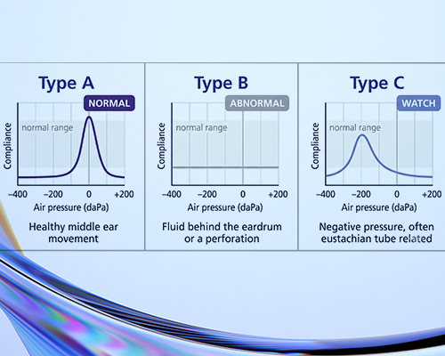 Tympanogram types