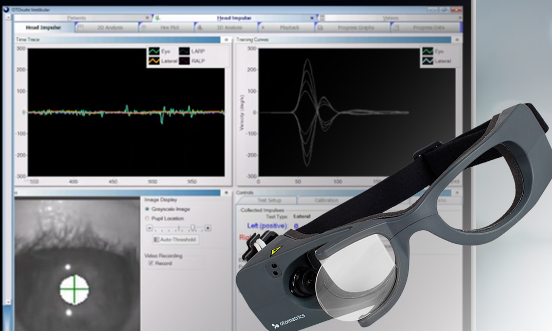 ICS Impulse, Tips from the Expert – Part 1