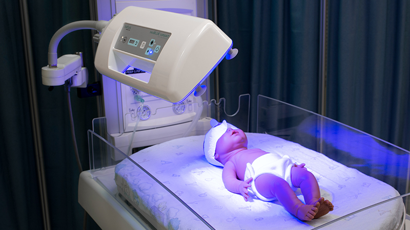 Infant receiving intensive blue LED phototherapy from the neoBLUE System for neonatal jaundice treatment with versatile phototherapy configurations.